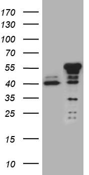 NFKBIE / IKB Epsilon Antibody (clone OTI6G9)