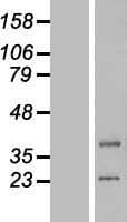 LIPT1 Protein (Over-Expression Lysate Myc-DDK (Flag))