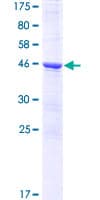Human LARP1B Protein (Recombinant GST)