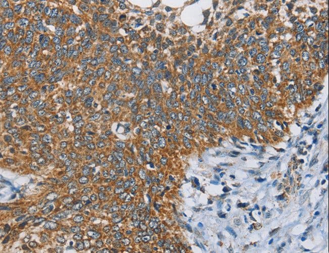 ANKHD1 Antibody