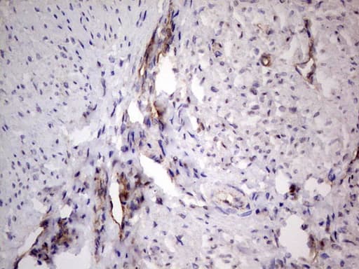 PROCR / EPCR Antibody (aa1-210, clone OTI13E1)