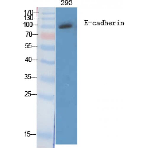 CDH1 / E Cadherin Antibody (810-890 aa, C-terminal)