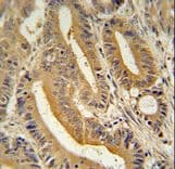 Polyclonal Rabbit anti-Human AP3S1 Antibody (aa1-30, IHC, WB)