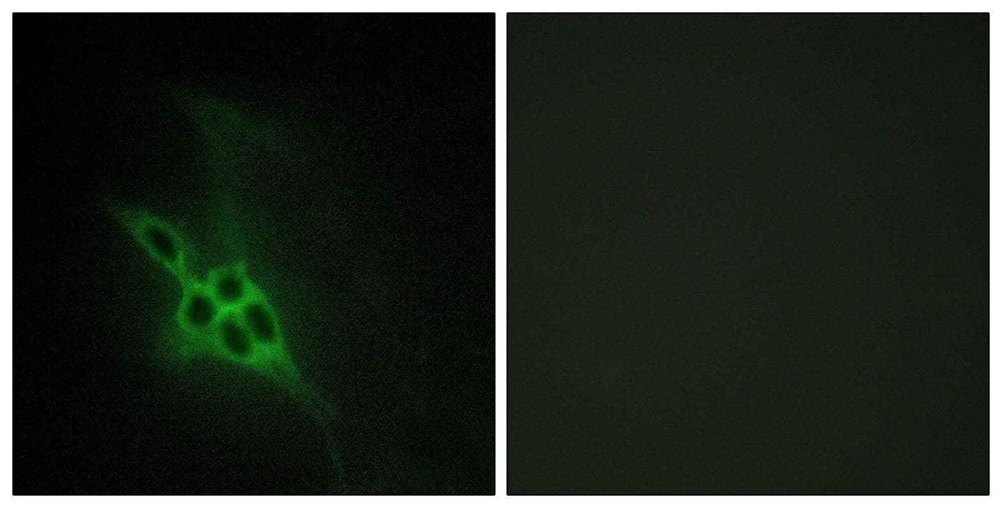 EPH Receptor B1+B2+B3 Antibody