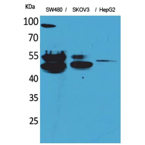 CFLAR / FLIP Antibody (N-Terminal)
