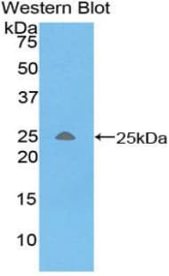 TREM1 Antibody (aa21-205)