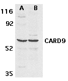 Polyclonal Rabbit anti-Human CARD9 Antibody (aa521-536, WB)