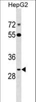 IHC-plus™ ARL10 Antibody (aa150-176)