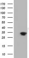 UCK1 Antibody (clone OTI6B6)