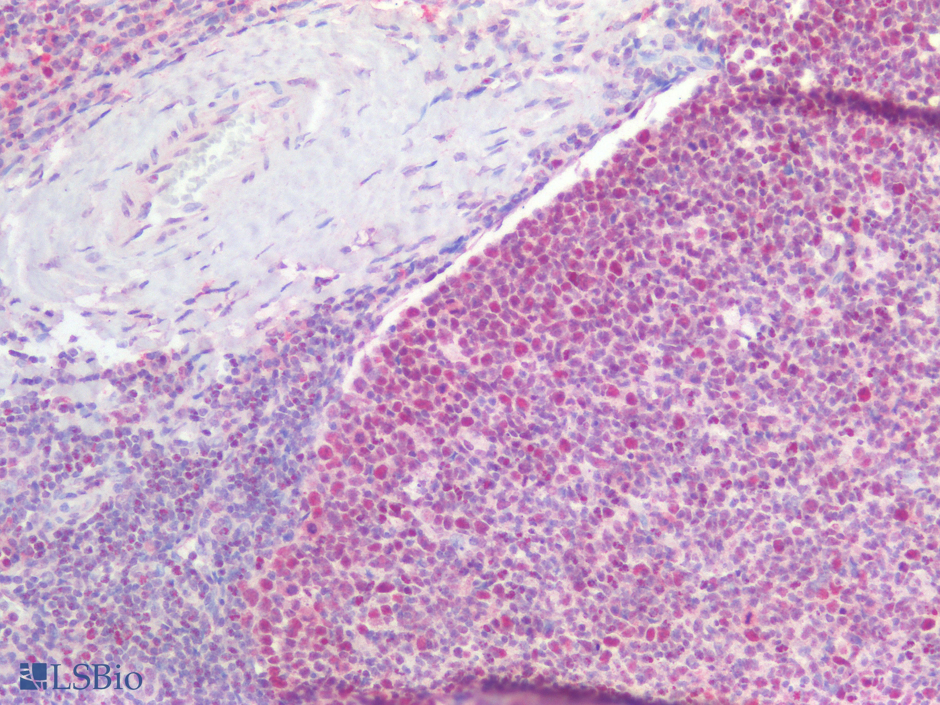 IHC-plus™ Polyclonal Rabbit anti-Human TNFSF4 / OX40L / CD252 Antibody (IHC)