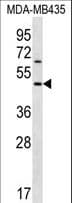 KERA / Keratocan Antibody (aa228-257)