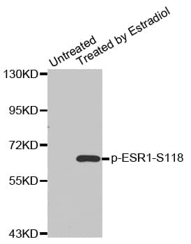 ER Alpha / Estrogen Receptor Antibody (phospho-Ser118)