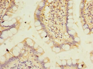 PPM1D / WIP1 Antibody