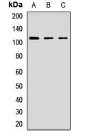 Polyclonal Rabbit anti-Human FAM40A Antibody (WB)