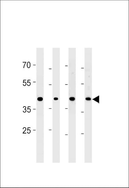CABLES2 Antibody (aa182-210)