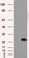 TPMT Antibody (clone OTI4B1)