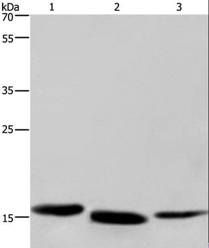 CYB5A / Cytochrome b5 Antibody