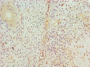 Polyclonal Rabbit anti-Human GAD1 / GAD67 Antibody (aa1-200, IHC, WB)