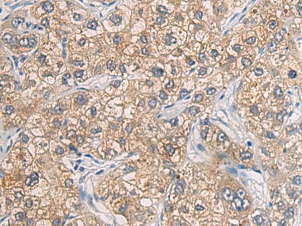 GAB4 Antibody