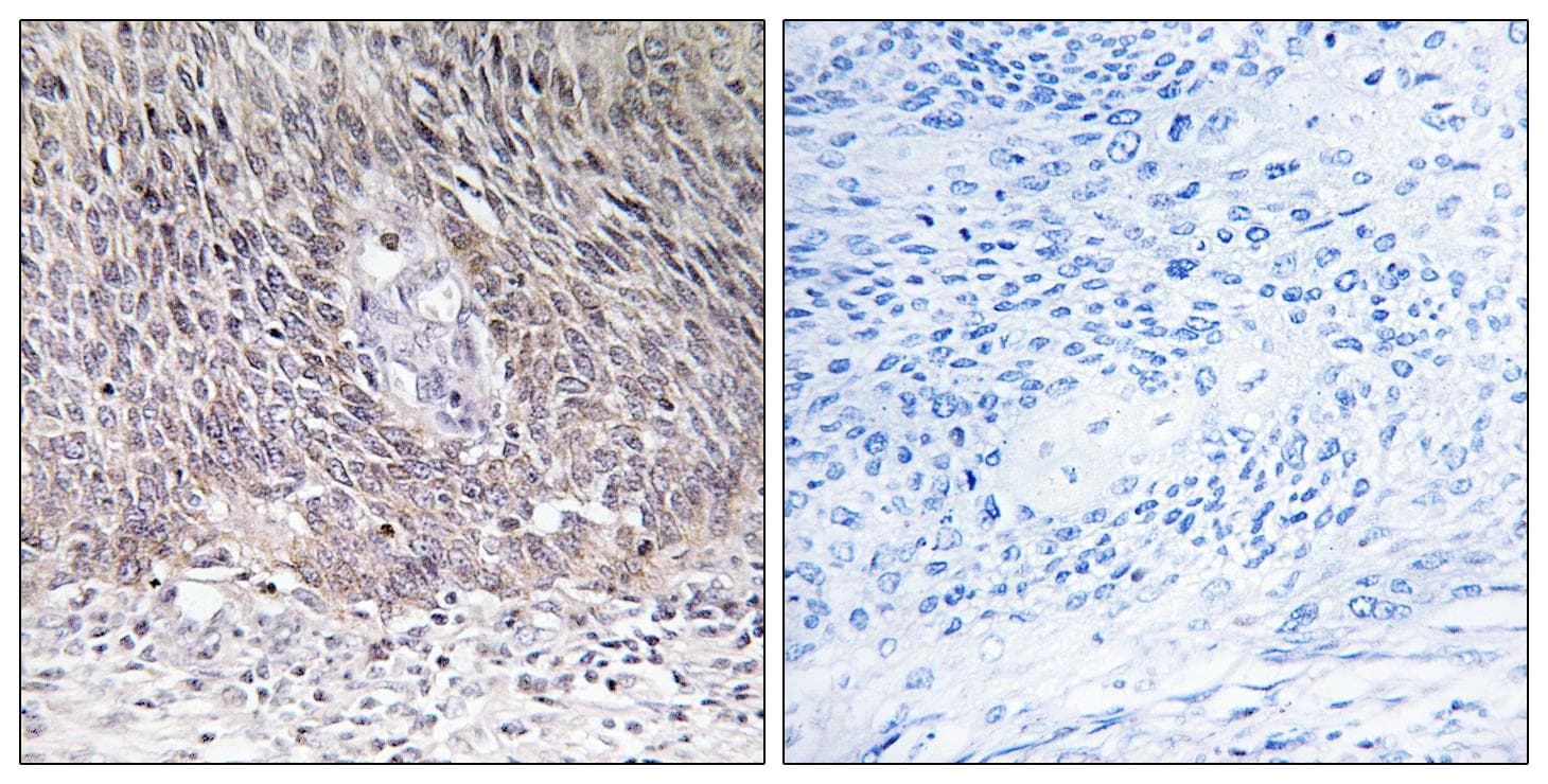 Polyclonal Rabbit anti-Human ARSA / Arylsulfatase A Antibody (IHC, WB)