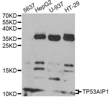 TP53AIP1 / p53 AIP1 Antibody