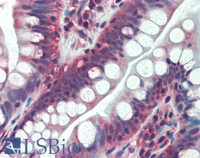 IHC-plus™ TFG Antibody (aa175-225)