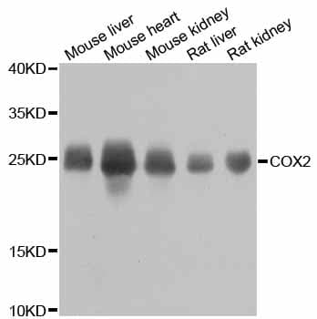Polyclonal Rabbit anti-Mouse MT-CO2 Antibody (IF, WB)