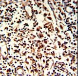 KIAA0226 / RUBICON Antibody (aa241-271)