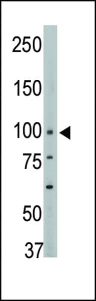 PTPN3 Antibody (aa366-397)