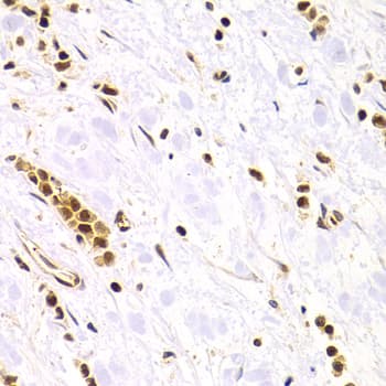 RAD50 Antibody