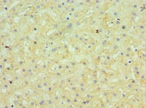 GUSB / Beta Glucuronidase Antibody (aa382-651)