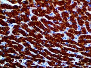 NOS2 / iNOS Antibody (clone RBT-iNOS)