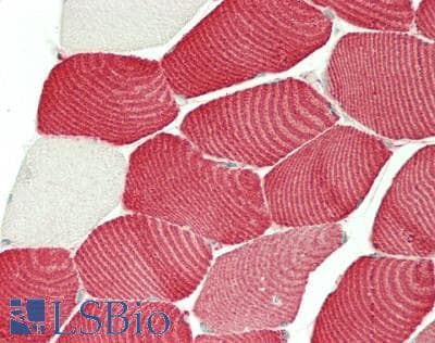 IHC-plus™ MYL3 Antibody (aa63-112)