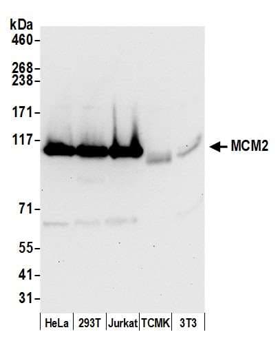 PathPlus™ Polyclonal Rabbit anti-Human MCM2 Antibody (aa1-50, IHC, WB)