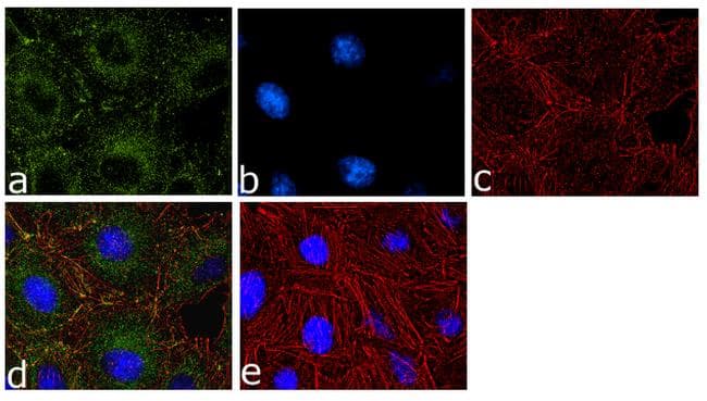 Monoclonal Mouse anti-Human PRMT3 Antibody (aa211-531)