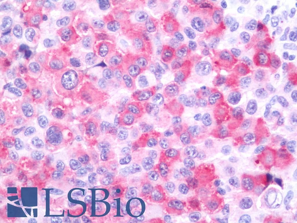 PathPlus™ Polyclonal Rabbit anti-Human WNT10A Antibody (Internal, IHC)