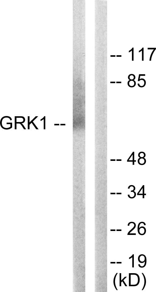 Rhodopsin Kinase / GRK1 Antibody (aa6-55)
