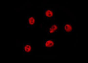 Polyclonal Rabbit anti-Human GTF2A1 / TFIIA Antibody (IHC, IF, WB)
