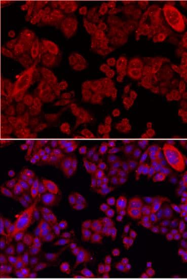 Polyclonal Rabbit anti-Human SMAD4 Antibody (IHC, IF, WB)