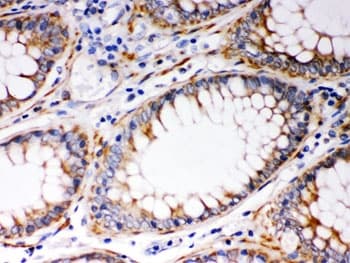 BAK1 / BAK Antibody