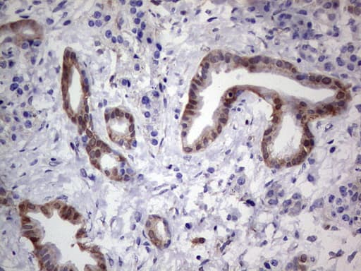 Monoclonal Mouse anti-Human LGALS3 / Galectin 3 Antibody (clone OTI15E4, IHC, WB)