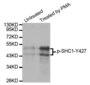 p66 / SHC Antibody (phospho-Tyr427)