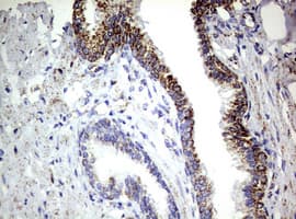 PIK3CD / PI3K Delta Antibody (aa286-610, clone OTI1D11)