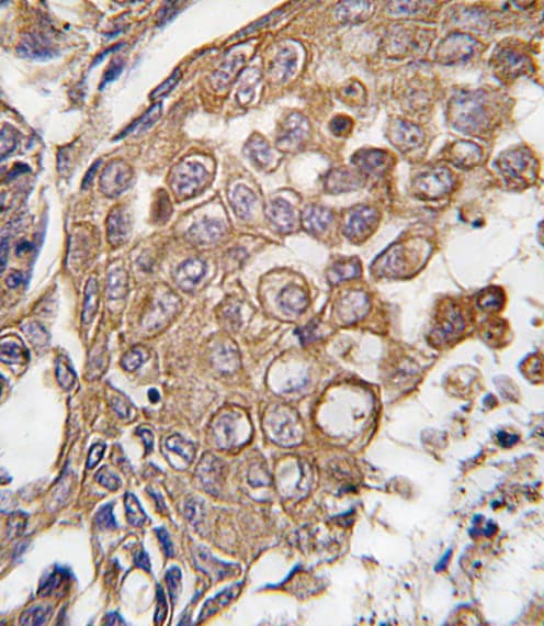 ALOX5AP / FLAP Antibody (aa86-117)