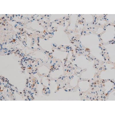AP-1 / JUND Antibody (phospho-Ser255)