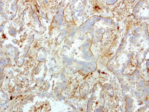 Monoclonal Mouse anti-Human S100A9 / MRP14 Antibody (clone UMAB174, IHC, WB)