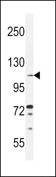 Polyclonal Rabbit anti-Human TLL2 Antibody (aa298-328, IHC, WB)