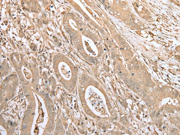 Polyclonal Rabbit anti-Human FAD104 / FNDC3B Antibody (IHC)