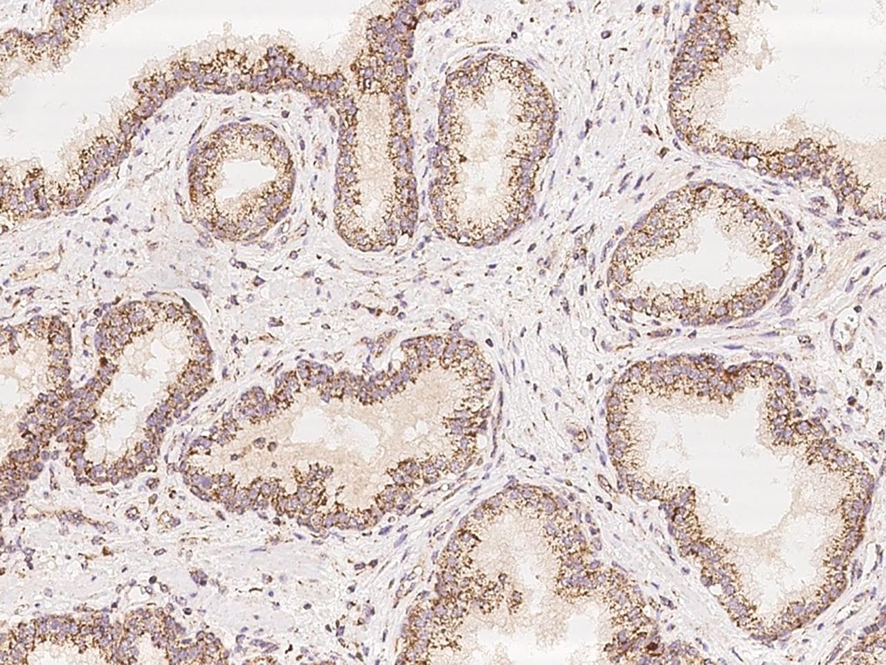 Polyclonal Rabbit anti-Human COQ2 Antibody (IHC)