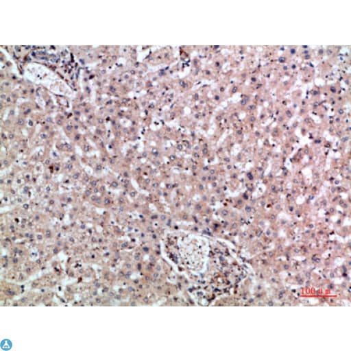 Polyclonal Rabbit anti-Human MIA2 Antibody (WB)